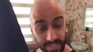 کاشت مو و ابرو ، عرفان علیرضایی :) کاشت مو