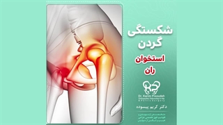 جراحی شکستگی گردن استخوان ران