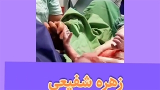 زایمان فیزیولوژیک