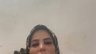 تنبلی تخمدان