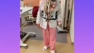 بیمار خانم 50 ساله اسکولیوز و تنگی کانال دیسک کمری