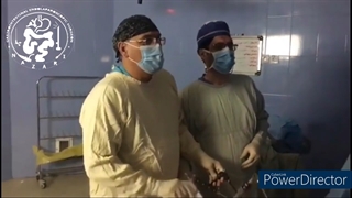 آشالازی چیست؟