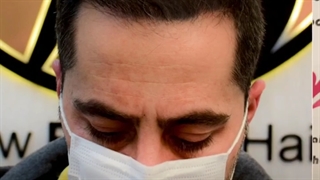 درصد موفقیت کاشت مو در کلینیک تخصصی پوست و مو جراحی فک