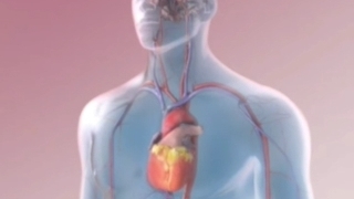 آیا می دانید سکته مغزی چگونه رخ می دهد؟