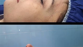 فیلم عمل جراحی زیبایی بینی