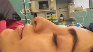 فیلم واقعی عمل جراحی بینی در اتاق عمل