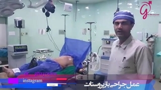عمل جراحی باز پروستات