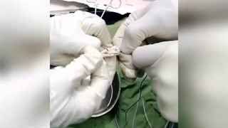 بازسازی رباط صلیبی