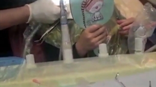 تـــرمیــم دندان یکتا عزیزم