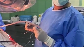 جراحی میکروسکوپی تومور مغزی