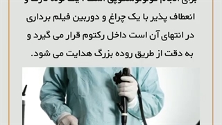 عملکرد کولونوسکوپی