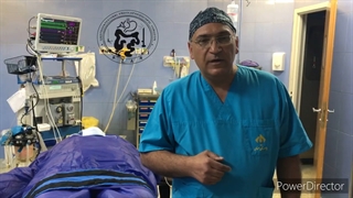 آندوسکوپی پیش از عمل اسلیوگاسترکتومی