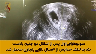 موضوع: مراجعه ی اول پس از انتقال دوجنین بلاست به لطف خدا بارداری موفق پس از و سه سال سابقه ی نازایی ivf