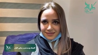 نمونه کار تزریق بوتاکس پیشانی