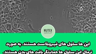 چگونه سلول های سالم اطراف تومور به پخش آن کمک می کنند