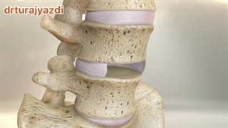 جــراحی ستــون فقــرات