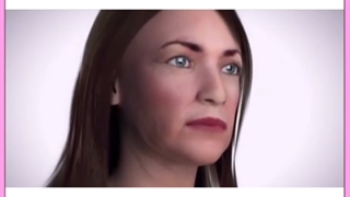 هایفوتراپی معجزه جوانسازی و لیفت صورت / هزینه و مزایا جراحی پف زیر چشم