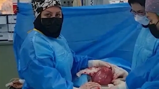 فیلم خارج سازی رحم