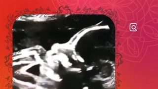 فیلم مکیدن انگشت جنین در شکم