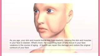 معرفی ۱۱ روش مدرن و معجزه گر لیفت صورت