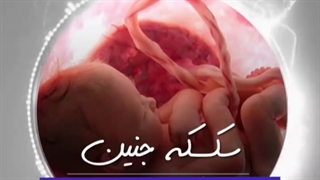 درباره سکسه جنین چه می دانید؟