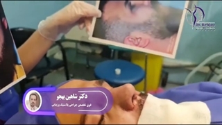 جراحی زیبایی بینی طبیعی