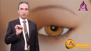 بلفاروپلاستی