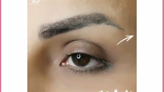 هزینه،روش ها و مزایای لیفت چشم بدون جراحی بلیچینگ