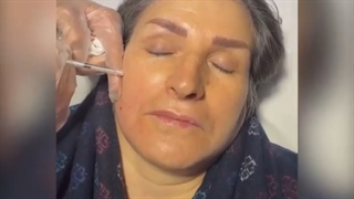 تزریق ژل جالپرو