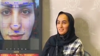 رضایت از بهترین مرکز کاشت ابرو در تهران