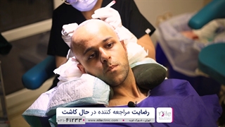 رضایت بیمار از کاشت مو در کلینیک نیل