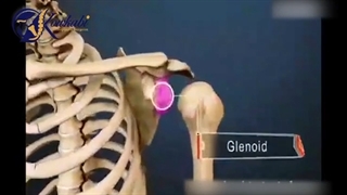 آرتروز مفصل شانه چه علائمی دارد؟