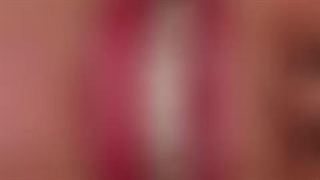 لمینت و کامپوزیت خوب در مشهد دکتر وکیلی