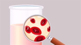 موارد تجویز آزمایش ادرار