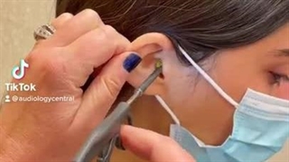 شنوایی سنجی