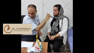 دکتر امیر حسین اسدالله پور تزریق ژل