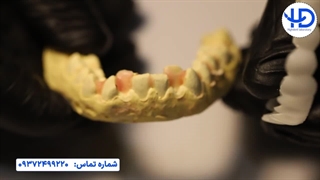 اسنپ اسمایل (تحلیل کیس کاری دو)