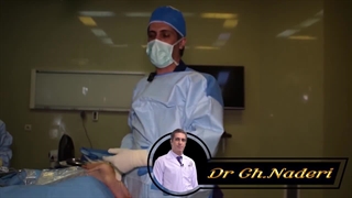 جراحی تاندون آشیل به روش تندینوسکوپی