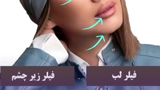 کلینیک زیبایی لیدا مشهد | سایت بهترین در مشهد کلینیک پوست