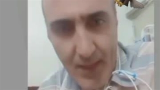 دلیل دیده نشدن جیوه در اینه