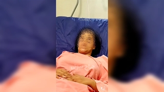 دکتر ابدومینوپلاستی مشهد