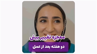 جراحی بینی مشهد