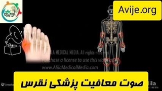 آیا امکان بررسی معافیت پزشکی نقرس در حین تحصیل وجود دارد؟