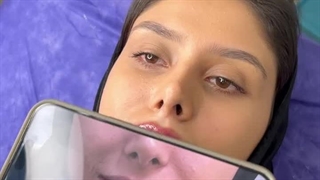 تزریق ژل همین الان
