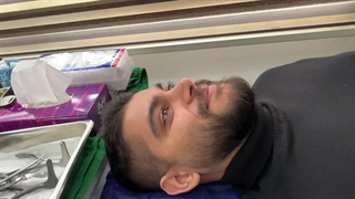 یکسال بعد عمل زیبایی بینی. دکتر عارف زاده