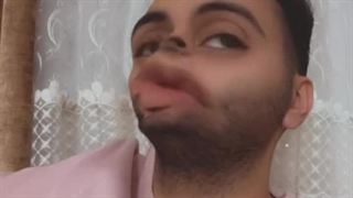 ببخشیدا......