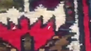 تأثیرات دستگاه‌های فراصوت بر قلب و سیستم عروقی انسان