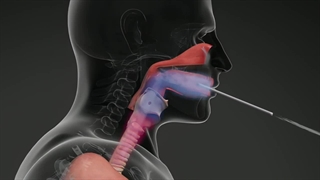 گرم کردن صدا و حنجره