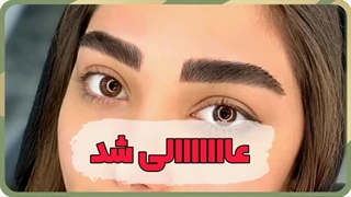 بهترین مرکز فیبروز ابرو در کیان شهر