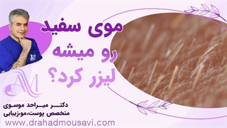 می‌دونی میشه که موهای سفیدت رو لیزر کنی